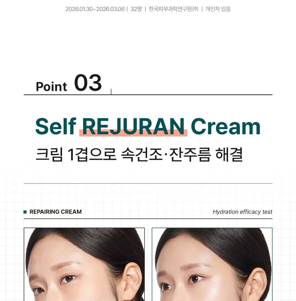 [최모나PICK][리쥬란 제약사_4배속 급속진정] 리쥬더마 EX 리페어링 크림 20g 상세페이지 15